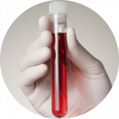 PAPP-A (ассоциированный с беременностью плазменный белок А)