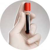 Антитела к Trichomonas vaginalis IgG