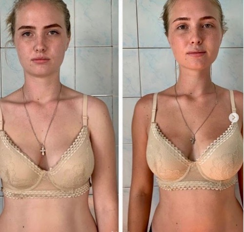 Восстановление молодости лица. 2.0 (Вера Красивая)