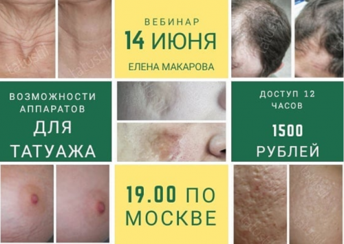 Возможности аппаратов для татуажа (Елена Макарова)