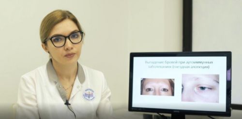 Мастер-класс Трихология. Брови (pandora_brows)