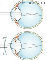 Близорукость лечение, 2014 (Николай Никитенко)