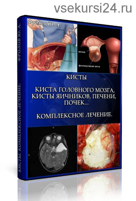 Кисты. Киста головного мозга, кисты яичников, печени, почек, мини инфопродукт №5 (Юрий Фролов)