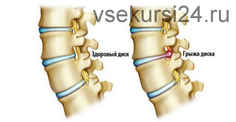 [ДумайДвигайся] Грыжа. Что делать и кто виноват? (Анна Воронина, Антон Шапочка)