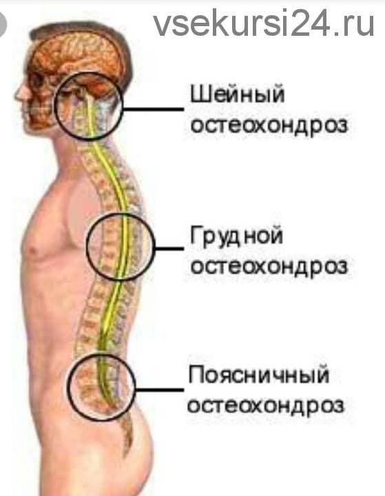 [Интераура] Лечение и профилактика: Остеохондроз