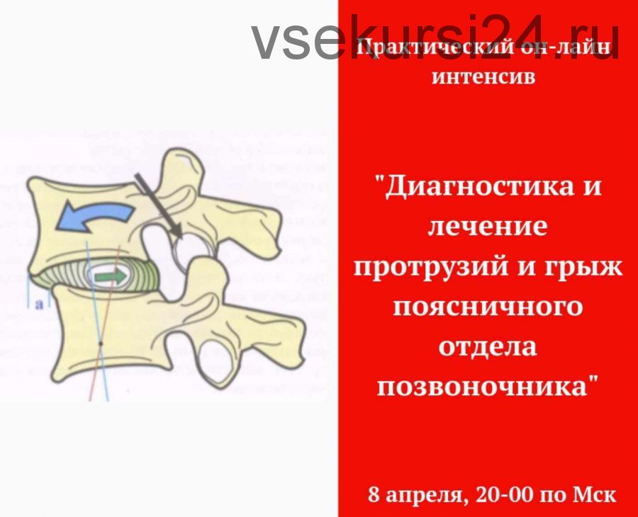 Диагностика и лечение грыж поясничного отдела (Игорь Атрощенко)