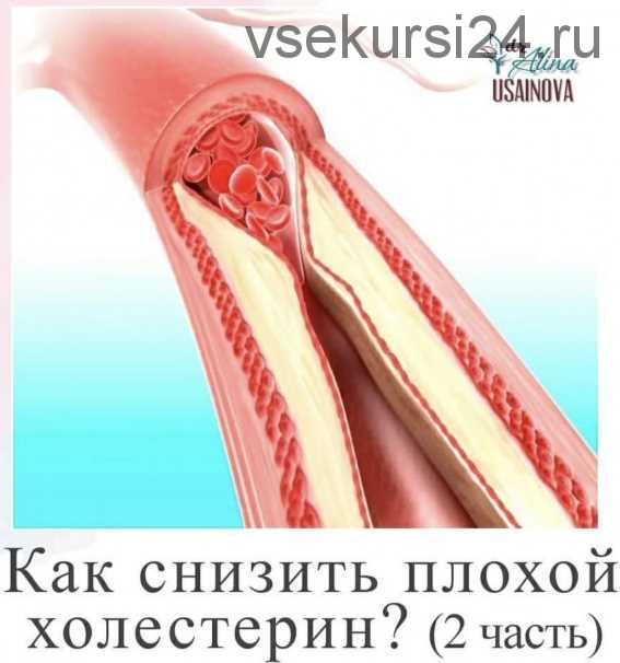 Как снизить плохой холестерин? 2 часть (Алина Усаинова)