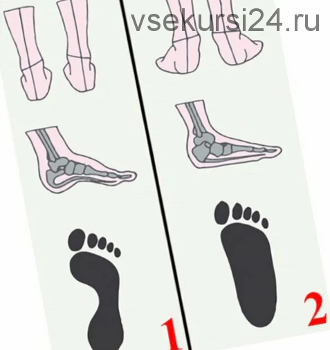 Как убрать плоскостопие за три недели (Елена Кей)