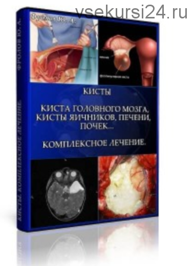 Кисты. Киста головного мозга, Кисты яичников, Печени, почек… Комплексное лечение (Юрий Фролов)