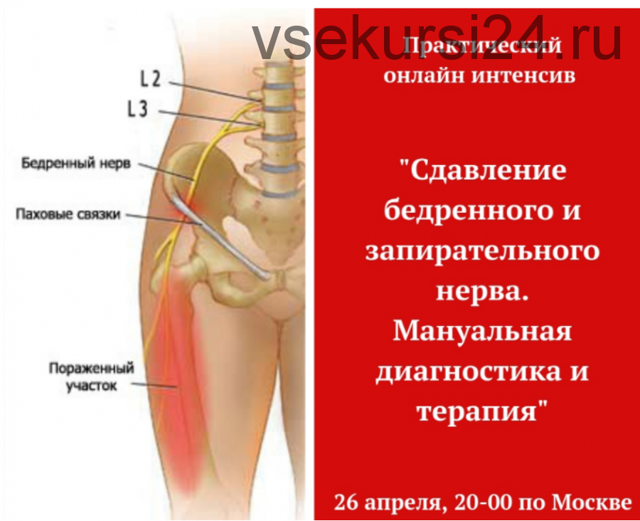 Сдавление бедренного и запирательного нерва (Игорь Атрощенко)