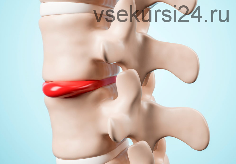 [Wellcom] Реабилитационный фитнес при межпозвонковых грыжах (Эльмира Хабибуллина)