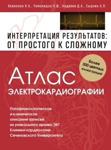 Атлас электрокардиографии. Интерпретация результатов: от простого к сложному - Чомахидзе Петр Шалвович