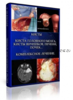 Кисты. Киста головного мозга, Кисты яичников, Печени, почек… Комплексное лечение (Юрий Фролов)