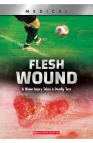 Flesh Wound. A Minor Injury Takes a Deadly Turn / Phillips Shea