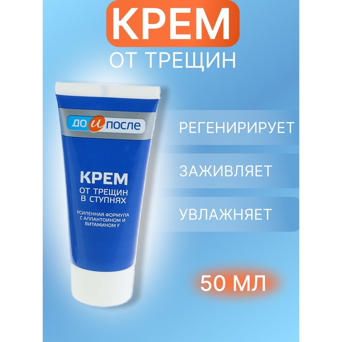 Крем для ног от трещин в ступнях, "До и После", 50 мл