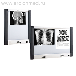 Светодиодные негатоскопы с матричным источником света Dixion X-view LED Matrix