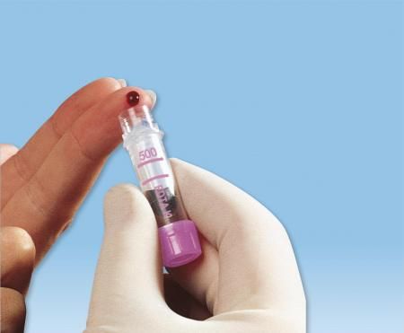 Микропробирки без капилляра для взятия капиллярной крови для глюкозы и лактаты, 0,5 мл, 10х45 мм